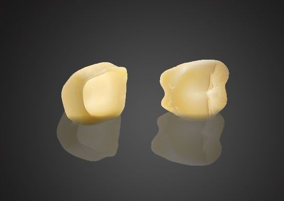 Beli 1440 Mpa Stabilitas Tinggi 3M Lava Estetika Zirconia Disesuaikan untuk Gigi Belakang pembuatan online