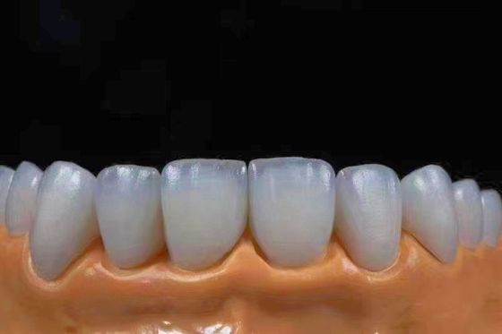 Beli Mahkota Zirconia Estetika Translucent Tinggi Pas dengan tampilan alami pembuatan online