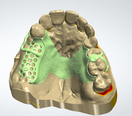 Beli Digital Metal Frame CAD CAM Dental Design Cocr Material Dengan Pencetakan 3D pembuatan online