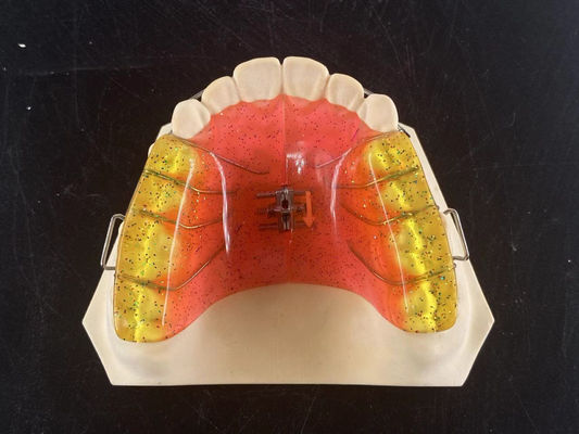 Beli Disesuaikan 2 Ways Dental Arch Expander Perangkat Ortodontik Disesuaikan pembuatan online