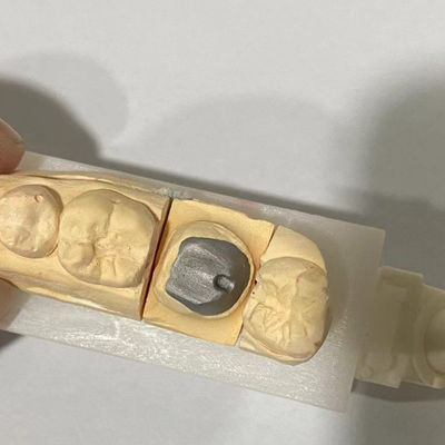 Cocr Metal Post And Core Wear Resistant Disesuaikan Untuk Restorasi Efisien