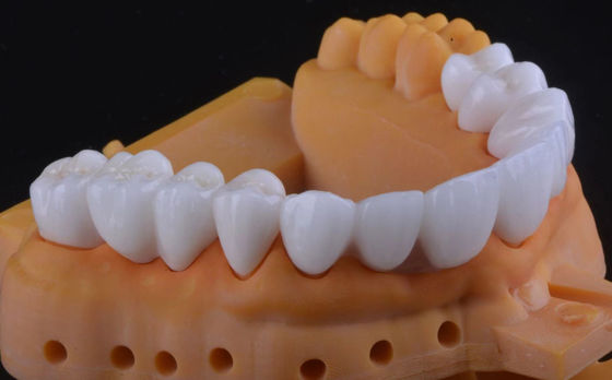 Tinggi Kekuatan Zirconia Dental Crown Ultra Translucent Dengan Stabil jangka panjang