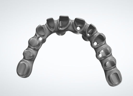 Dental Lab Crown Dental CAD CAM Sistem Disesuaikan Untuk Restorasi Gigi