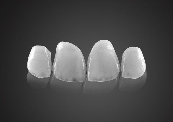 IPS 0.2mm Ultra Thin Emax Veneers tahan noda dengan kekuatan tinggi