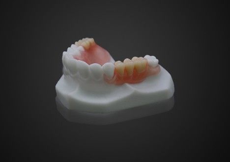 Ringan Nyaman Valplast Parsial Denture Mudah dibersihkan Transparansi tinggi