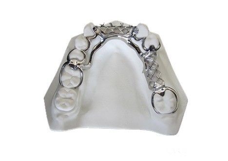 Anti Coloring Vitallium Parsial Denture Disesuaikan Untuk Lama Bertahan