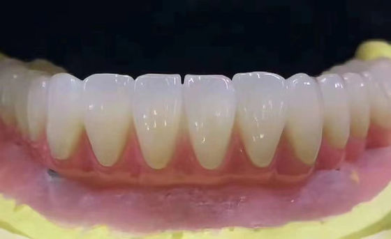 Customized Dental Zirconia Tooth Crown tahan noda dengan presisi tinggi