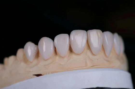 Long Lasting Multi-Layered Keramik Zirconia Mahkota disesuaikan dengan FDA Certified