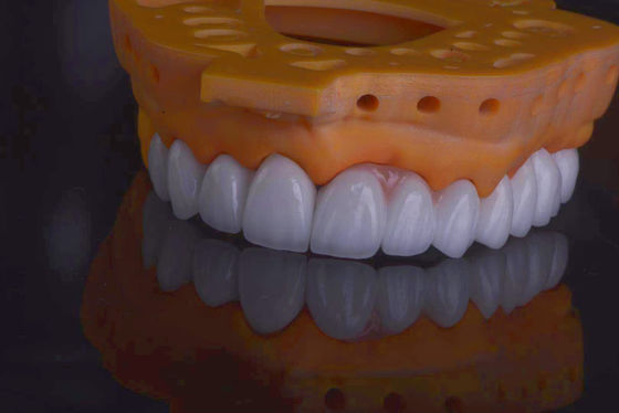 High Strength Dental Lab Crown alami mencari restorasi gigi