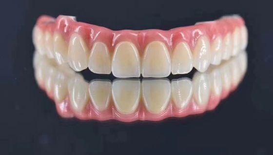 Lab Gigi Disesuaikan Implantasi Dukungan Metal Mahkota alami Mencari Stabilitas jangka panjang