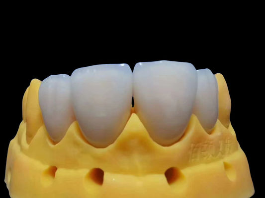 Tahi air mata Fitting lengkap Zirconia mahkota customizable aman untuk digunakan