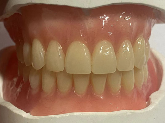Hipolergenik Custom Removable Parsial Denture Dengan Warna Gum Pink