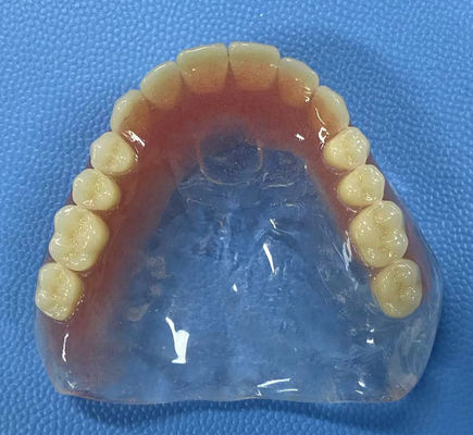 Ketahanan terhadap noda Full Acrylic Denture Stabilitas tinggi dengan bentuk lengkungan penuh