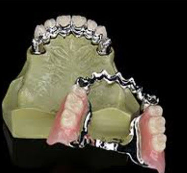 Penggunaan Jangka Panjang Key dan Keyway Dental Disesuaikan Dengan Kekuatan Tinggi
